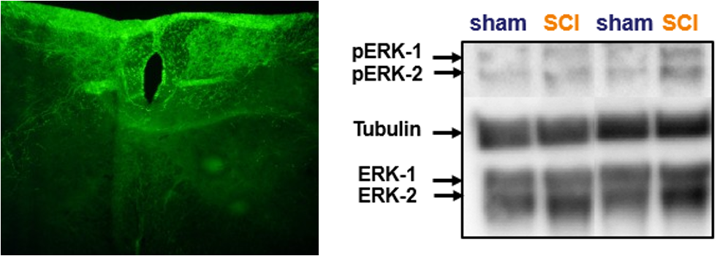 Studies on the neuronal/glial mechanisms influencing spinal nociceptive plasticity.