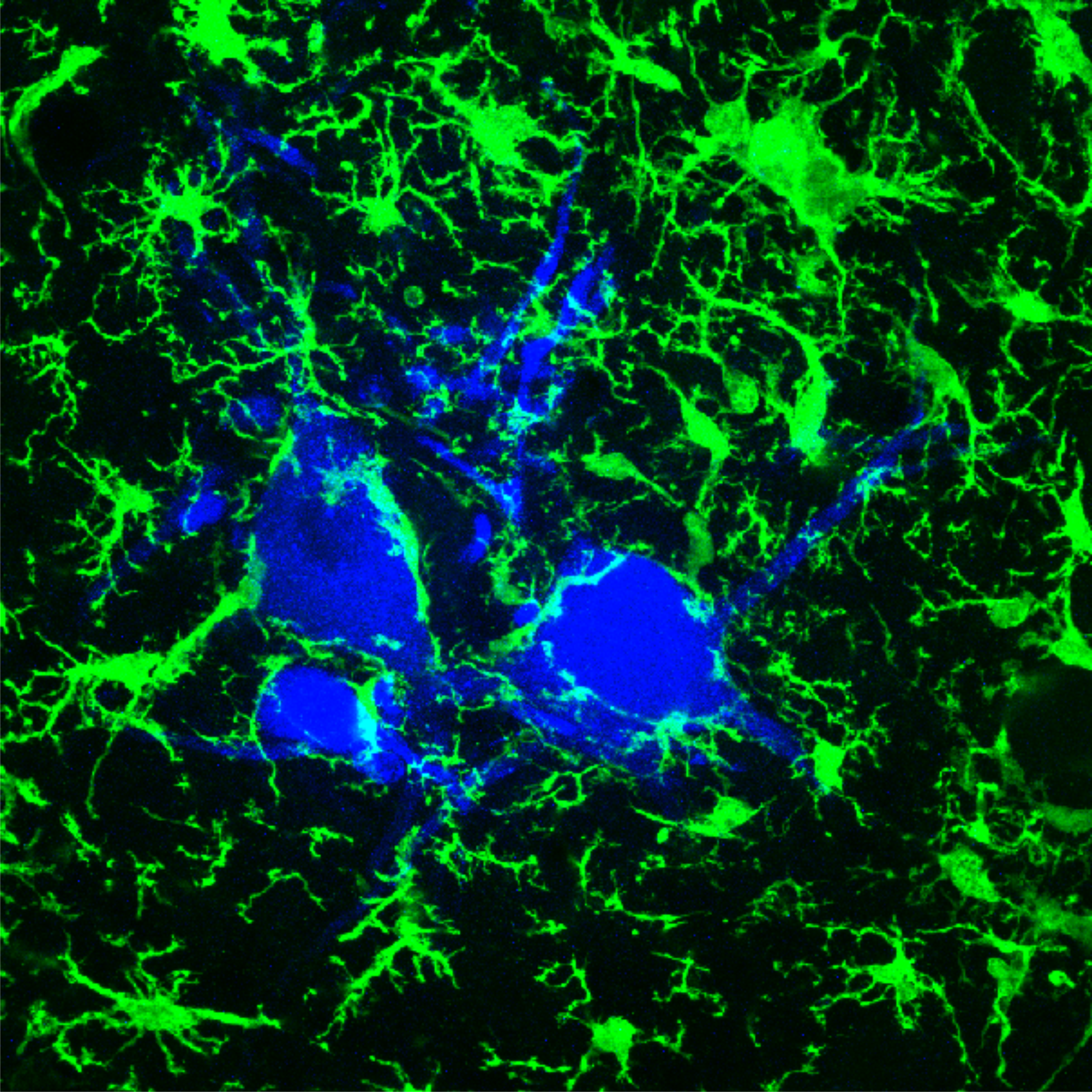 Microglia surrounding axotomized motoneurons