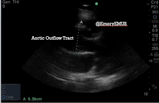 Back Pain Emergency ultrasound image 5