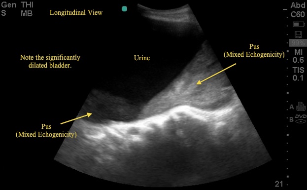 sagittal2