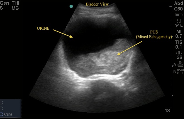 suprapubic area