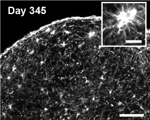 Astrocyte development can be monitored for months in organoid culture