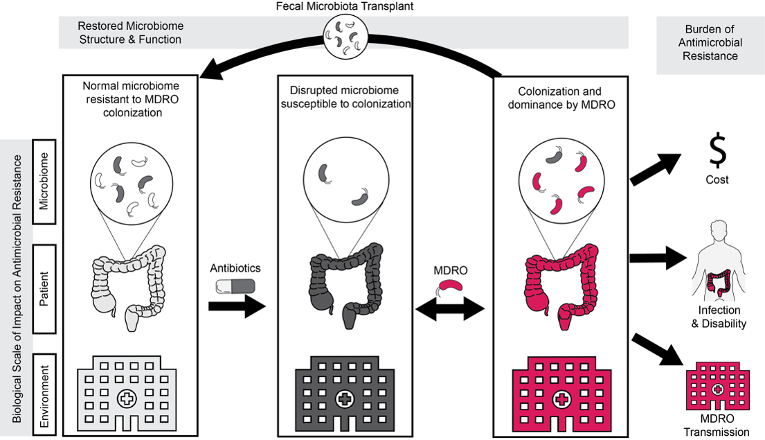 Fecal Microbiota Transplant Diagram