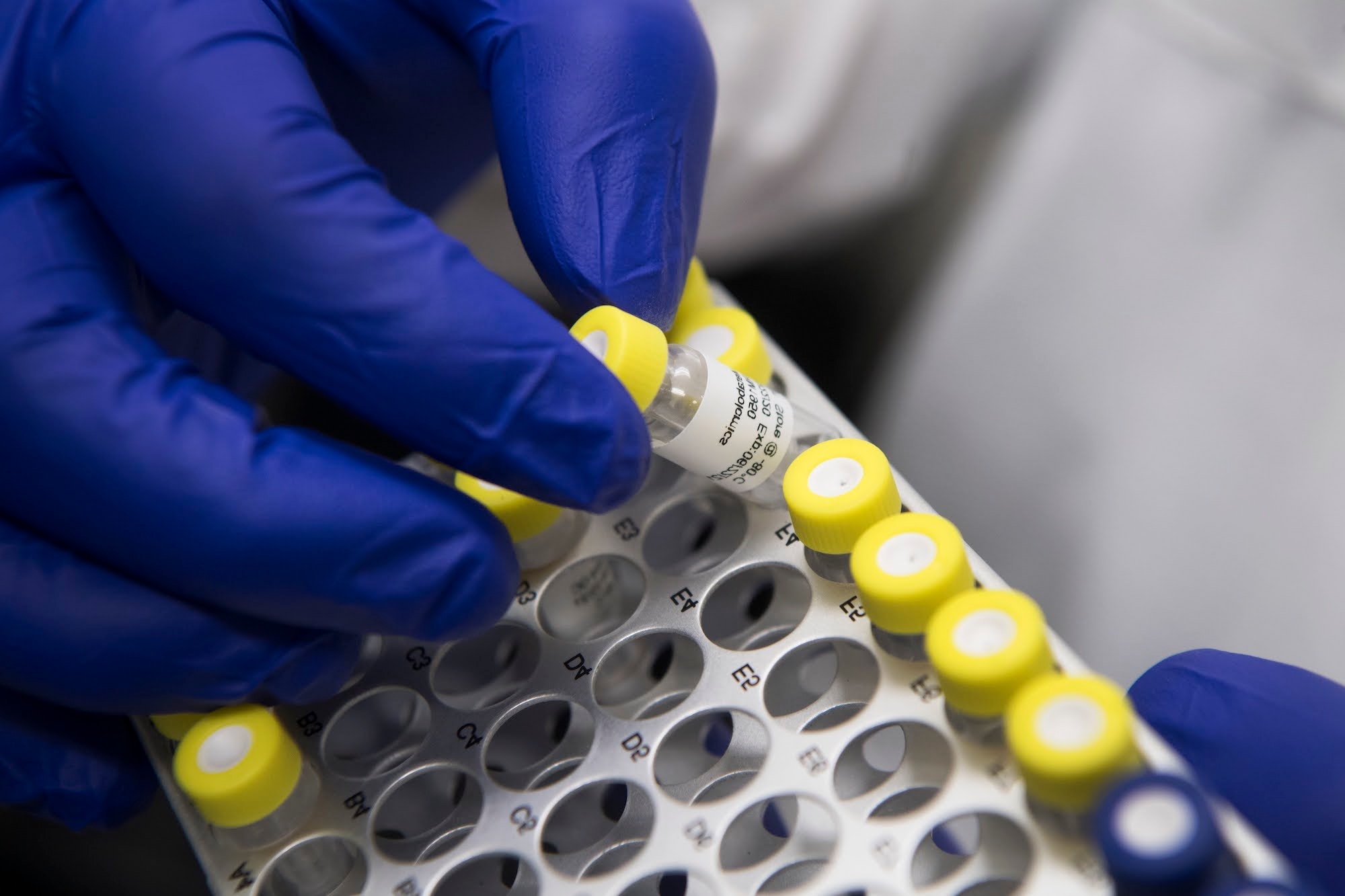 Scientist investigates a tray of vials
