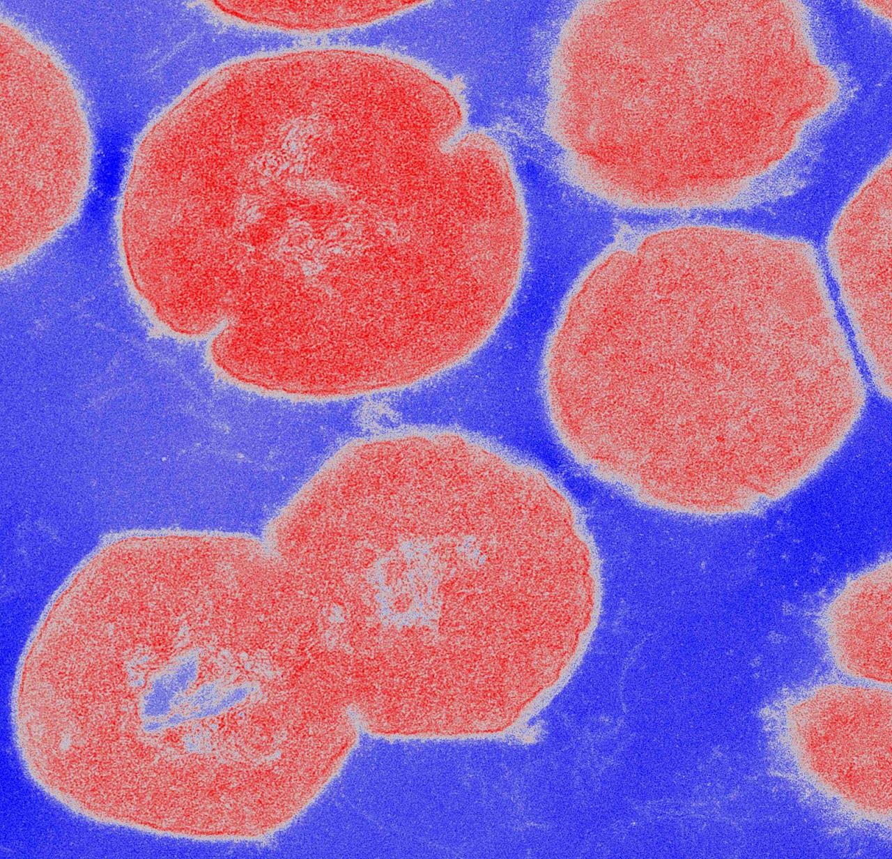 Cationic antimicrobial peptide resistance mechanisms of streptococcal pathogens