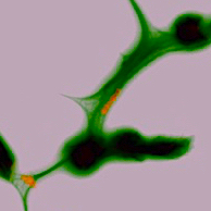 Streptococcal M1 Strikes by Neutralizing Cathelicidins