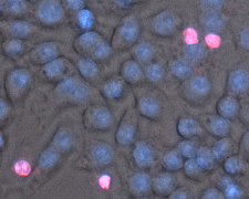  Inflammasome/IL-1β responses to streptococcal pathogens