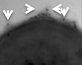 Group A streptococcal M1 protein provides resistance against the antimicrobial activity of histones