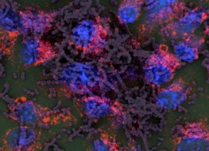 Group A streptococcal M protein activates the NLRP3 inflammasome