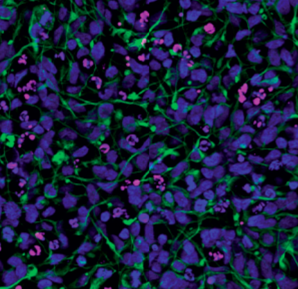 Zika virus infection