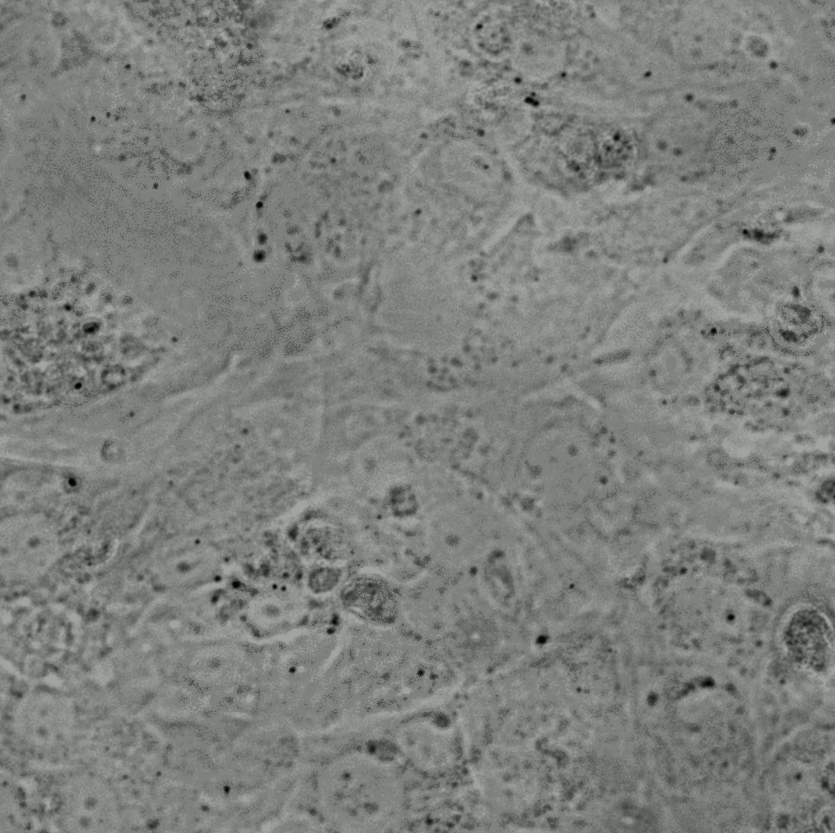  Inflammasome inhibition protects against cardiac glycoside cellular toxicity
