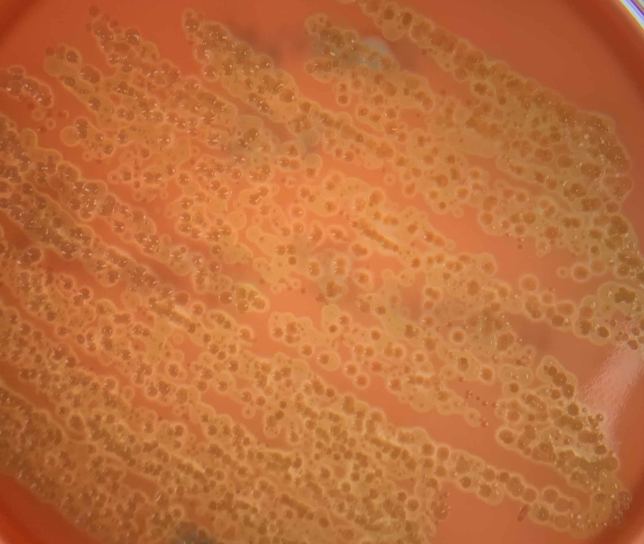 anti-interlekin-6 immunotherapy on opportunistic invasive infection by group A Streptococcus