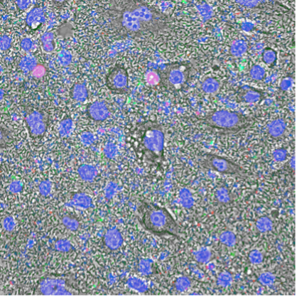 pro-IL-18 allows keratinocytes to initiate inflammation during bacterial infection