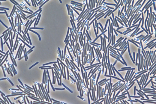 C Diff Cells 520