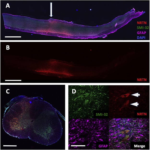 Gene Delivery