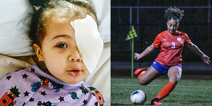 2 images of Marley Camp - one as an infant with an eye patch and the other as a soccer player in her high school