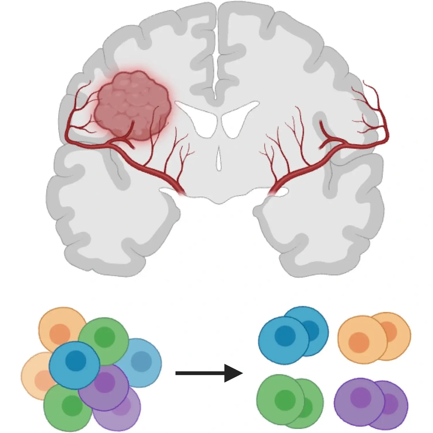 Pediatric Brain Cancers