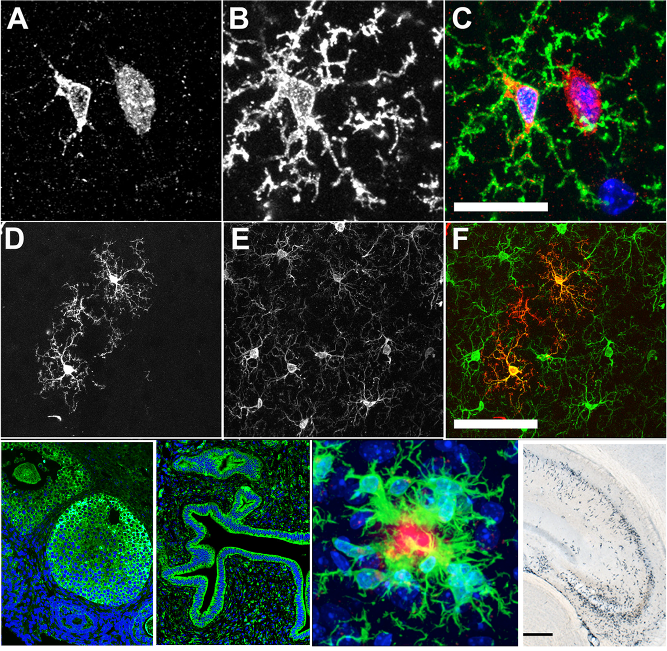 Varvel lab scientific images related to SURE summer program funding 2023