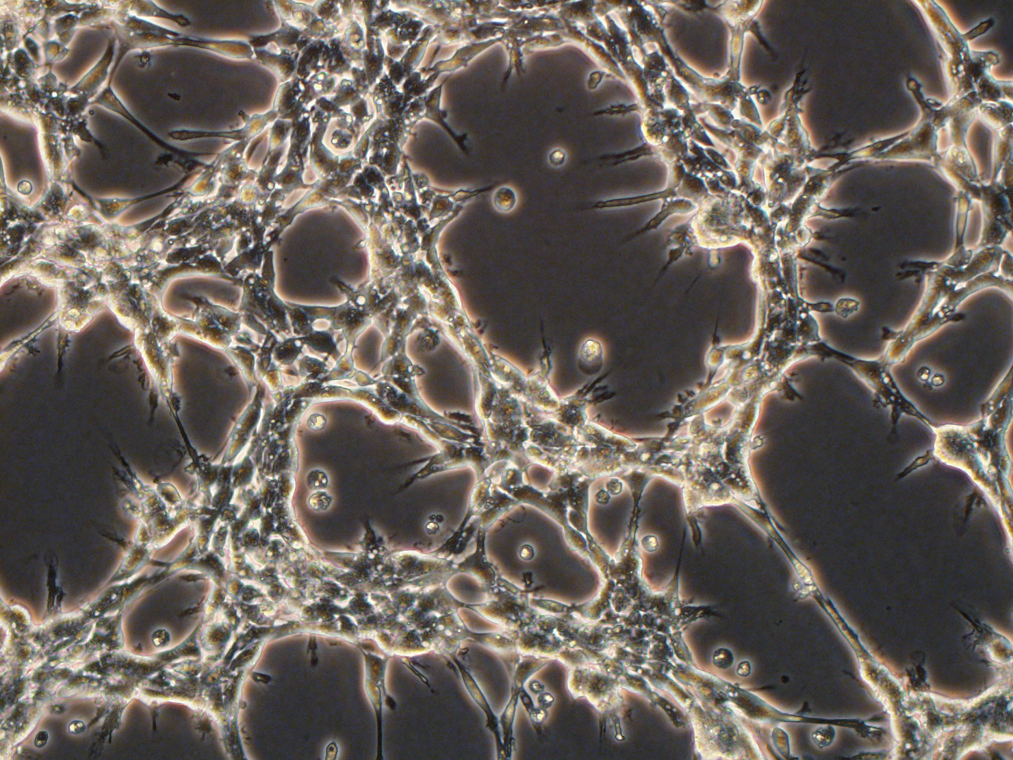 Patient Glioblastoma Cultures and Xenografts