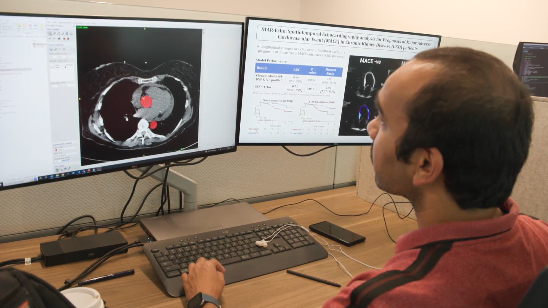 person seated at a computer workstation looking at two large screens with CT scan images on one monitor and data on the other