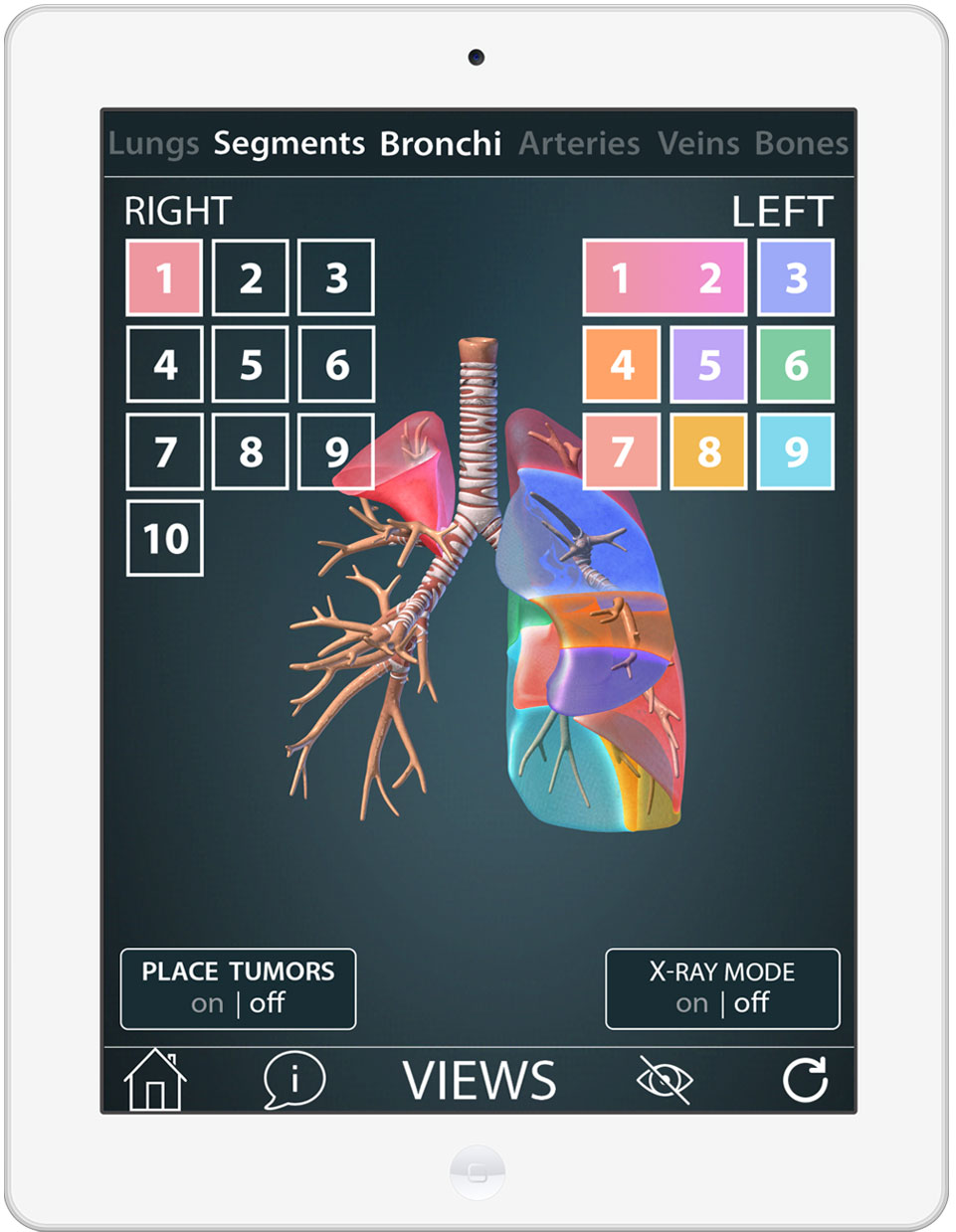 CSAT's Surgical Anatomy of the Lung app