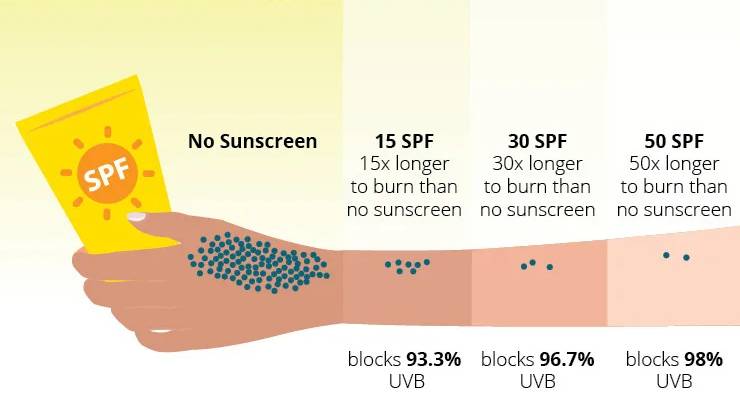 illustration of a tube of sunscreen and an arm with different levels of sun damage