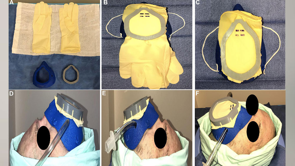 Ventilated Upper Airway Endoscopic Endonasal Procedure Mask